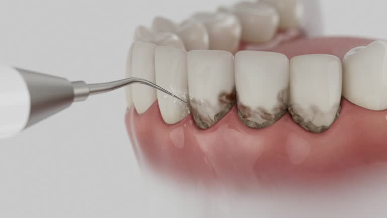 Reliable Emergency Dentist contractor in Decherd, TN by Smile Center Dentistry
